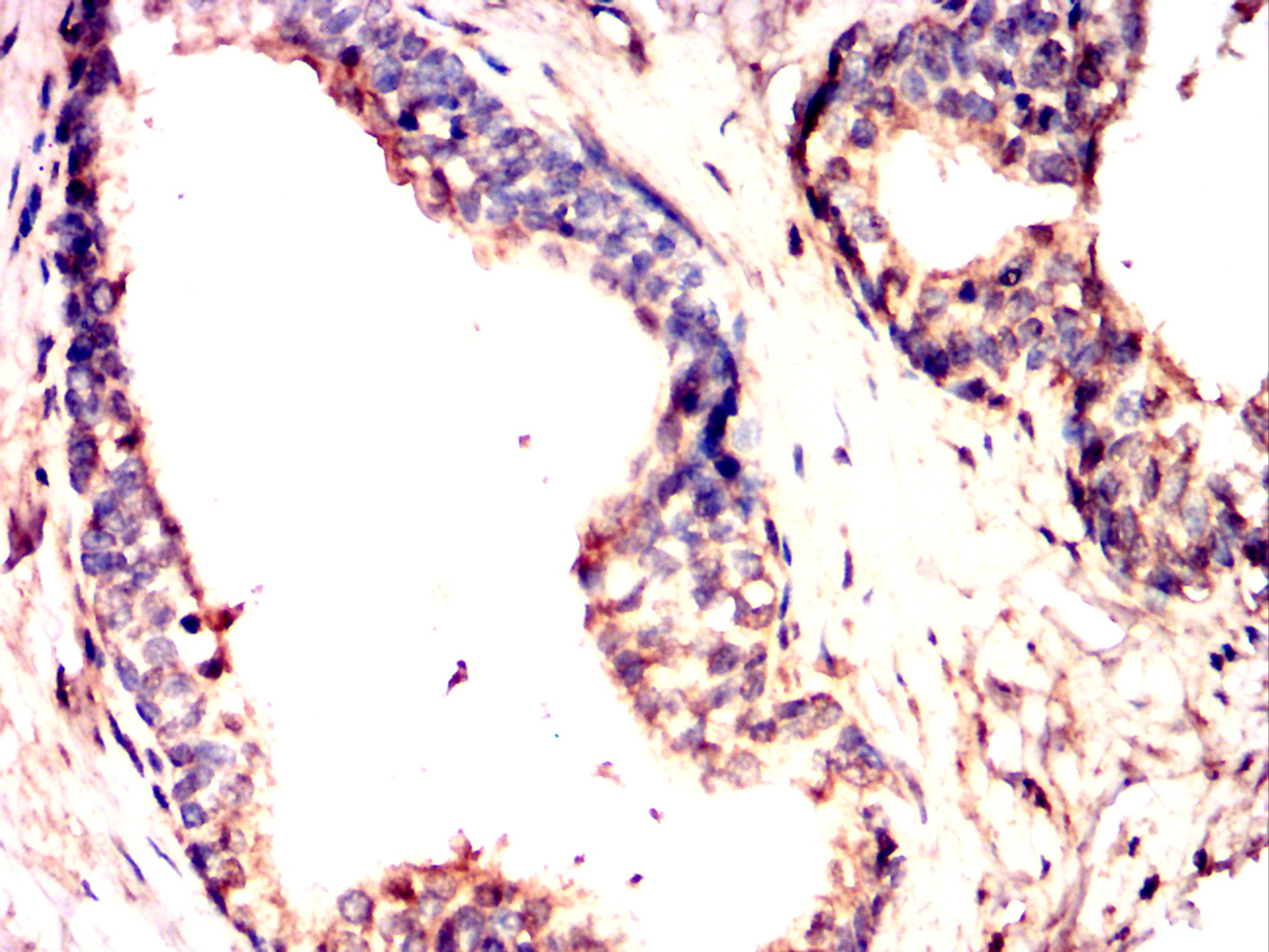 		IHC